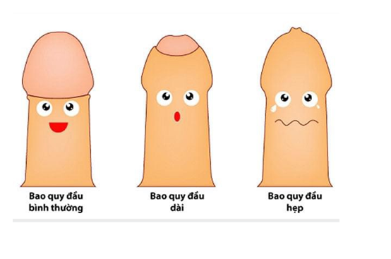 Chữa bệnh hẹp bao quy đầu