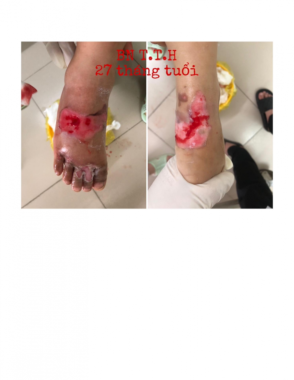 a22bbbcf9730107c4fdc5b39a34e2abd 4